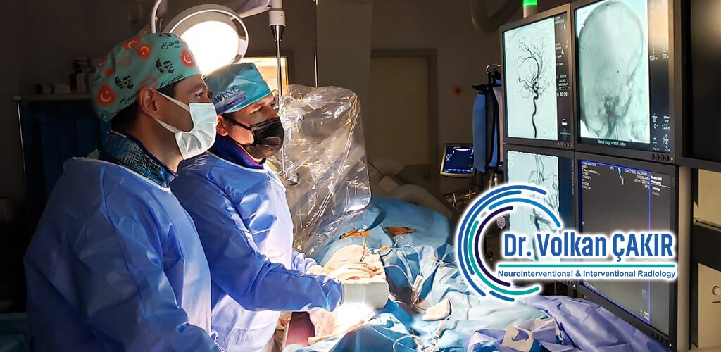 Best Interventional Radiology Doctors Dubai