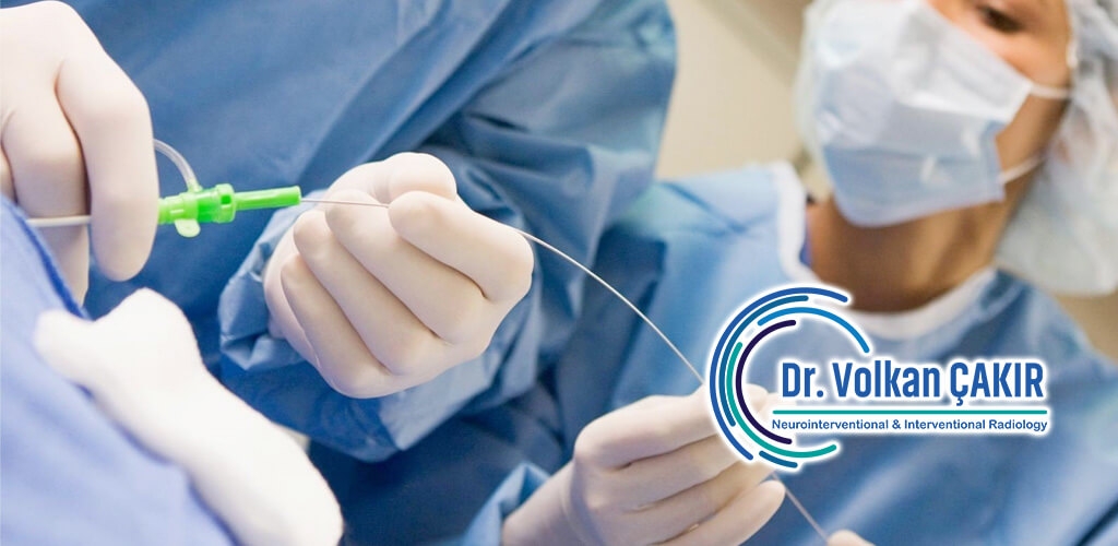 Interventional Radiology Al Ain